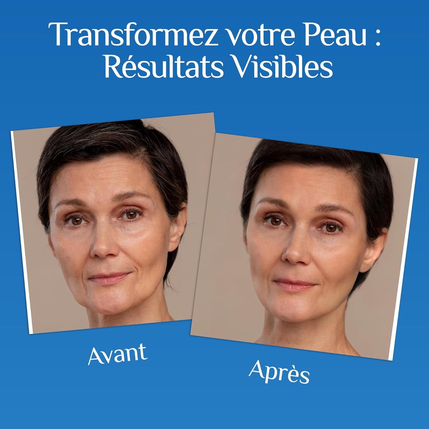 Acide Hyaluronique Sérum Visage Pour Microneedling + Vitamine C & E | Soin Visage Et Contour Des Yeux | anti Cerne, anti Ride, anti Tache & anti Age | 60 Ml